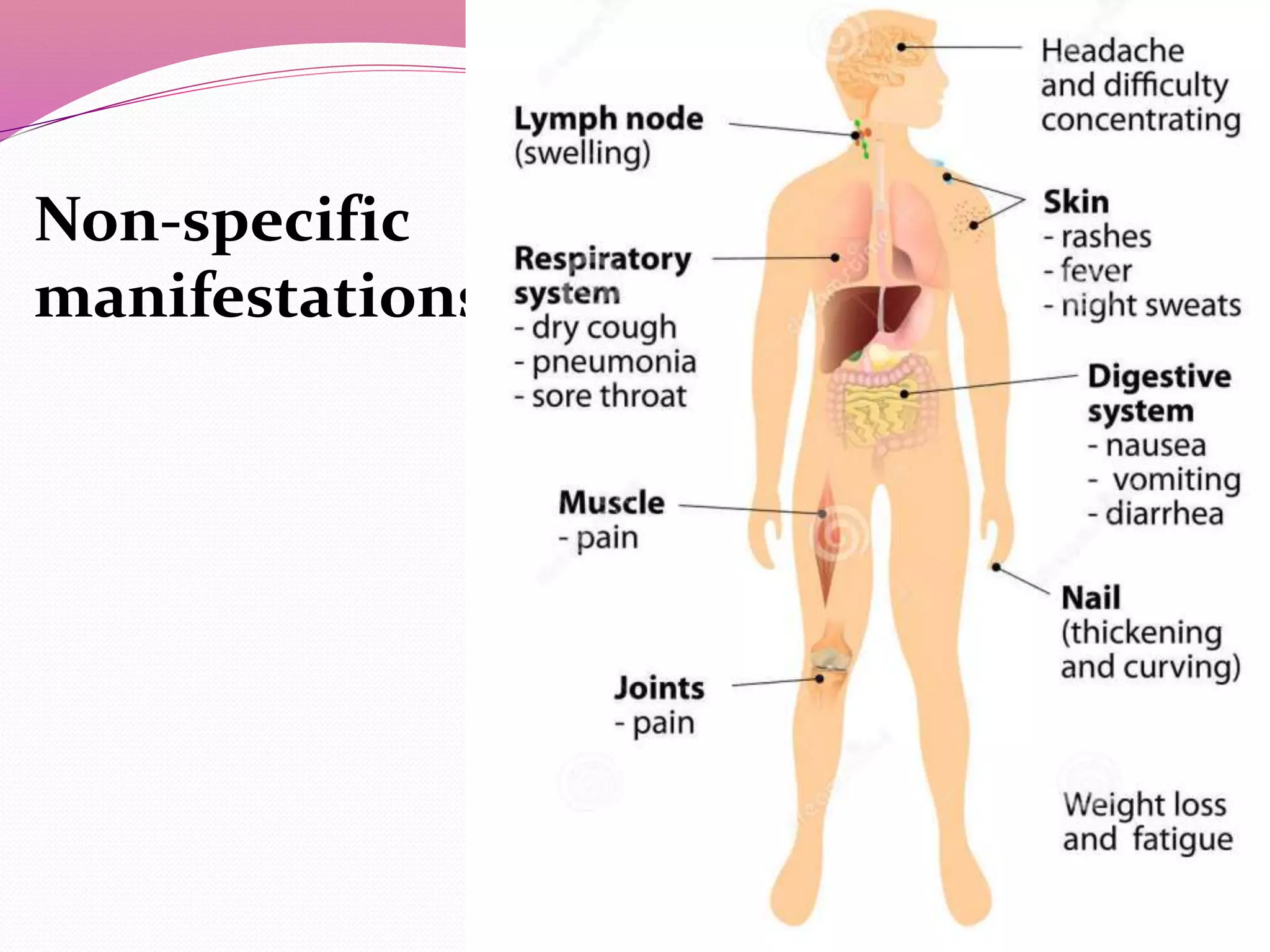 Non-specific
manifestations: