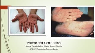 Sexually transmitted disease (STD).pptx