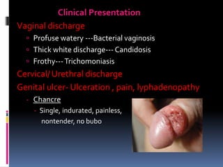 Clinical Presentation
Vaginal discharge
 Profuse watery ---Bacterial vaginosis
 Thick white discharge--- Candidosis
 Frothy---Trichomoniasis
Cervical/ Urethral discharge
Genital ulcer- Ulceration , pain, lyphadenopathy
- Chancre
- Single, indurated, painless,
nontender, no bubo
 