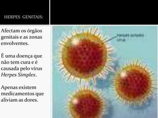 HERPES  GENITAIS:Afectam os órgãos genitais e as zonas envolventes.É uma doença que não tem cura e é causada pelo vírus Herpes Simplex.Apenas existem medicamentos que aliviam as dores.