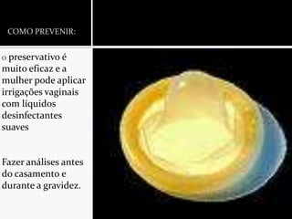 COMO PREVENIR:O preservativo é muito eficaz e a mulher pode aplicar irrigações vaginais com líquidos desinfectantes suavesFazer análises antes do casamento e durante a gravidez.