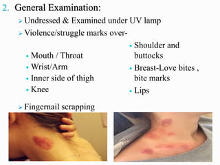 2. General Examination:
➢ Undressed & Examined under UV lamp
➢ Violence/struggle marks over-
➢ Fingernail scrapping
 Mouth / Throat
 Wrist/Arm
 Inner side of thigh
 Knee
 Shoulder and
buttocks
 Breast-Love bites ,
bite marks
 Lips
 