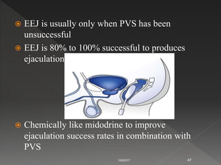  EEJ is usually only when PVS has been
unsuccessful
 EEJ is 80% to 100% successful to produces
ejaculation
 Chemically like midodrine to improve
ejaculation success rates in combination with
PVS
1/8/2017 47
 