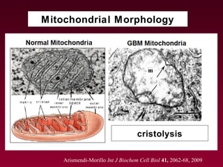 Mitochondrial Morphology
Arismendi-Morillo Int J Biochem Cell Biol 41, 2062-68, 2009
cristolysis
 