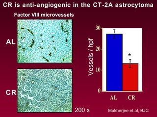 AL
CR
CR is anti-angiogenic in the CT-2A astrocytoma
Mukherjee et al, BJC
0
10
20
30
AL CR
Vessels/hpf
*
200 x
Factor VIII microvessels
 