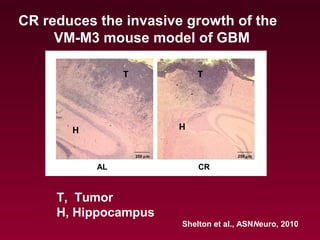 H
TT
H
AL CR
250 µm 250 µm
CR reduces the invasive growth of the
VM-M3 mouse model of GBM
T, Tumor
H, Hippocampus
Shelton et al., ASNNeuro, 2010
 