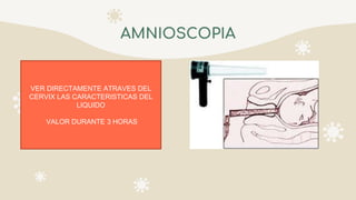 AMNIOSCOPIA
VER DIRECTAMENTE ATRAVES DEL
CERVIX LAS CARACTERISTICAS DEL
LIQUIDO
VALOR DURANTE 3 HORAS
 