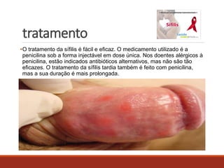 tratamento 
•O tratamento da sífilis é fácil e eficaz. O medicamento utilizado é a 
penicilina sob a forma injectável em dose única. Nos doentes alérgicos à 
penicilina, estão indicados antibióticos alternativos, mas não são tão 
eficazes. O tratamento da sífilis tardia também é feito com penicilina, 
mas a sua duração é mais prolongada. 
 