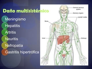 Sífilis secundariaCecchiniGonzalez, Silvia Ayala "Infectologia y Enfermedades Infecciosas" 1 ed. JournalManual CTO Infectología 7° Edición
