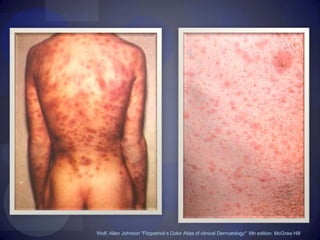 Daño multisistémico