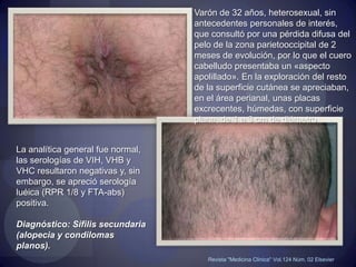 ERUPCIONES PAPULOESCAMOSAS EN REGIÓN PLANTARLesiones altamente infectanteshttp://www.nejm.org/doi/full/10.1056/NEJMicm1005345#figure=f1