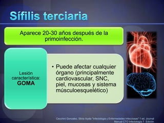 Sífilis latente tardíaCecchiniGonzalez, Silvia Ayala "Infectologia y Enfermedades Infecciosas" 1 ed. JournalManual CTO Infectología 7° Edición