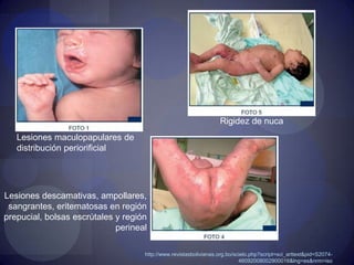 Sífilis y embarazoCecchiniGonzalez, Silvia Ayala "Infectologia y Enfermedades Infecciosas" 1 ed. Journal