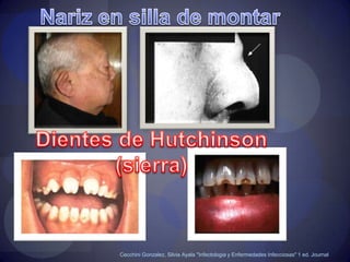 De los que nazcan el 50% morirá dentro de los primeros 3 meses.