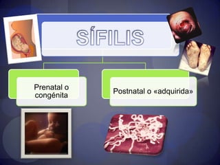 Elementos antigénicos del TreponemaRomero Cabello "Mircobiología y Parasitología Humana" 3ª ed