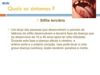 Quais os sintomas ? Sífilis terciária  Um terço das pessoas que desenvolvem o período de latência da sífilis desenvolvem a terceira fase da doença que se desenvolve de 10 a 40 anos após ter sido infectado. Durante esta fase a doença afecta o cérebro, a artéria aorta e o próprio coração. Isso pode levar a uma grave doença cardíaca, lesão cerebral, paralisia e morte. 