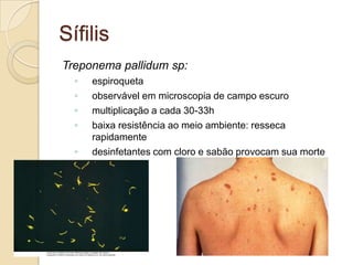 Sífilis
Treponema pallidum sp:
◦ espiroqueta
◦ observável em microscopia de campo escuro
◦ multiplicação a cada 30-33h
◦ baixa resistência ao meio ambiente: resseca
rapidamente
◦ desinfetantes com cloro e sabão provocam sua morte
 