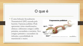 O que é
• É uma Infecção Sexualmente
Transmissível (IST) causada pela
bactéria Treponema pallidum. Pode
apresentar várias manifestações
clínicas e diferentes estágios (sífilis
primária, secundária e terciária). Nos
estágios primário e secundário da
infecção, a possibilidade de
transmissão é maior. 
 