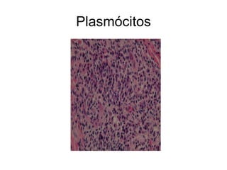 Plasmócitos
 