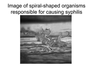 Image of spiral-shaped organisms
responsible for causing syphilis
 
