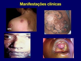 Manifestações clínicas
 