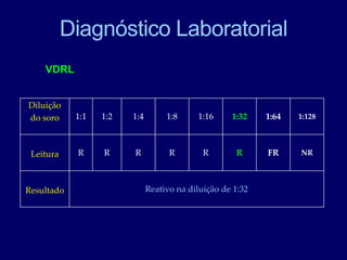 Diagnóstico Laboratorial
VDRL
Diluição
do soro 1:1 1:2 1:4 1:8 1:16 1:32 1:64 1:128
Leitura R R R R R R FR NR
Resultado Reativo na diluição de 1:32
 