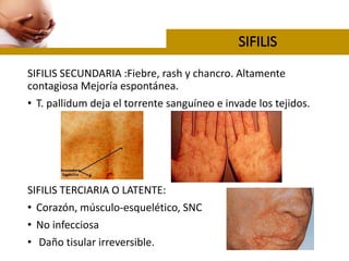 SIFILIS SECUNDARIA :Fiebre, rash y chancro. Altamente
contagiosa Mejoría espontánea.
• T. pallidum deja el torrente sanguíneo e invade los tejidos.
SIFILIS TERCIARIA O LATENTE:
• Corazón, músculo-esquelético, SNC
• No infecciosa
• Daño tisular irreversible.
 