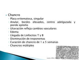  Chancro
◦ Placa eritematosa, singular
◦ Anular, bordes elevados, centro adelgazada y
pierde epitelio
◦ Ulceración refleja cambios vasculares
◦ Edema
◦ Llegada de Linfocitos T y B
◦ Disminución de treponemas
◦ Curación de chancro de 1 a 5 semanas
◦ Chancros múltiples
Lucero. Sífilis. FARO.
 
