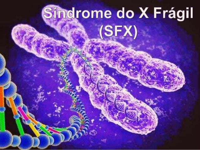 O que é a SFX?
Condição de origem genética.
Causa mais frequente de comprometimento intelectual herdado.
Atraso no desenvo...