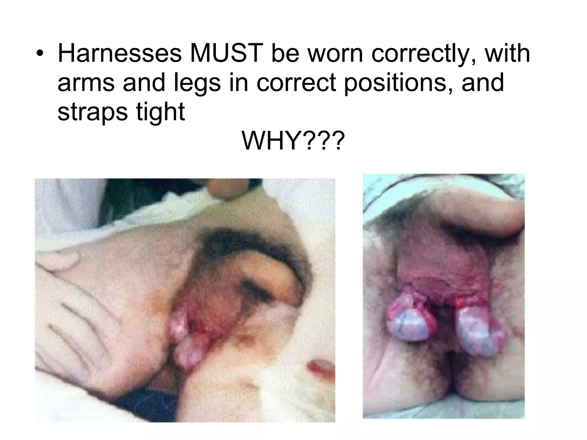 Harnesses MUST be worn correctly, with arms and legs in correct positions, and straps tight  WHY??? 