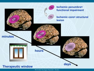 Ischemic core= structural
lesion
minutes
hours
days
Ischemic penumbra=
functional impairment
Therapeutic window
 