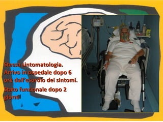 Stessa sintomatologia.Stessa sintomatologia.
Arrivo in ospedale dopo 6Arrivo in ospedale dopo 6
ore dall’esordio dei sintomi.ore dall’esordio dei sintomi.
Stato funzionale dopo 2Stato funzionale dopo 2
giornigiorni
 