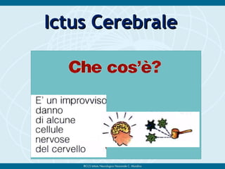 Ictus CerebraleIctus Cerebrale
 