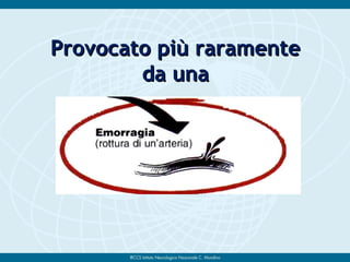Provocato più raramenteProvocato più raramente
da unada una
 