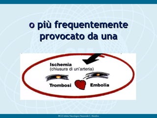 oo più frequentementepiù frequentemente
provocato da unaprovocato da una
 