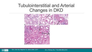 Tubulointerstitial and Arterial
Changes in DKD
Clin J Am Soc Nephrol 12: 2032–2045, 2017 Am J Kidney Dis. 71(6):884-895,2018
 