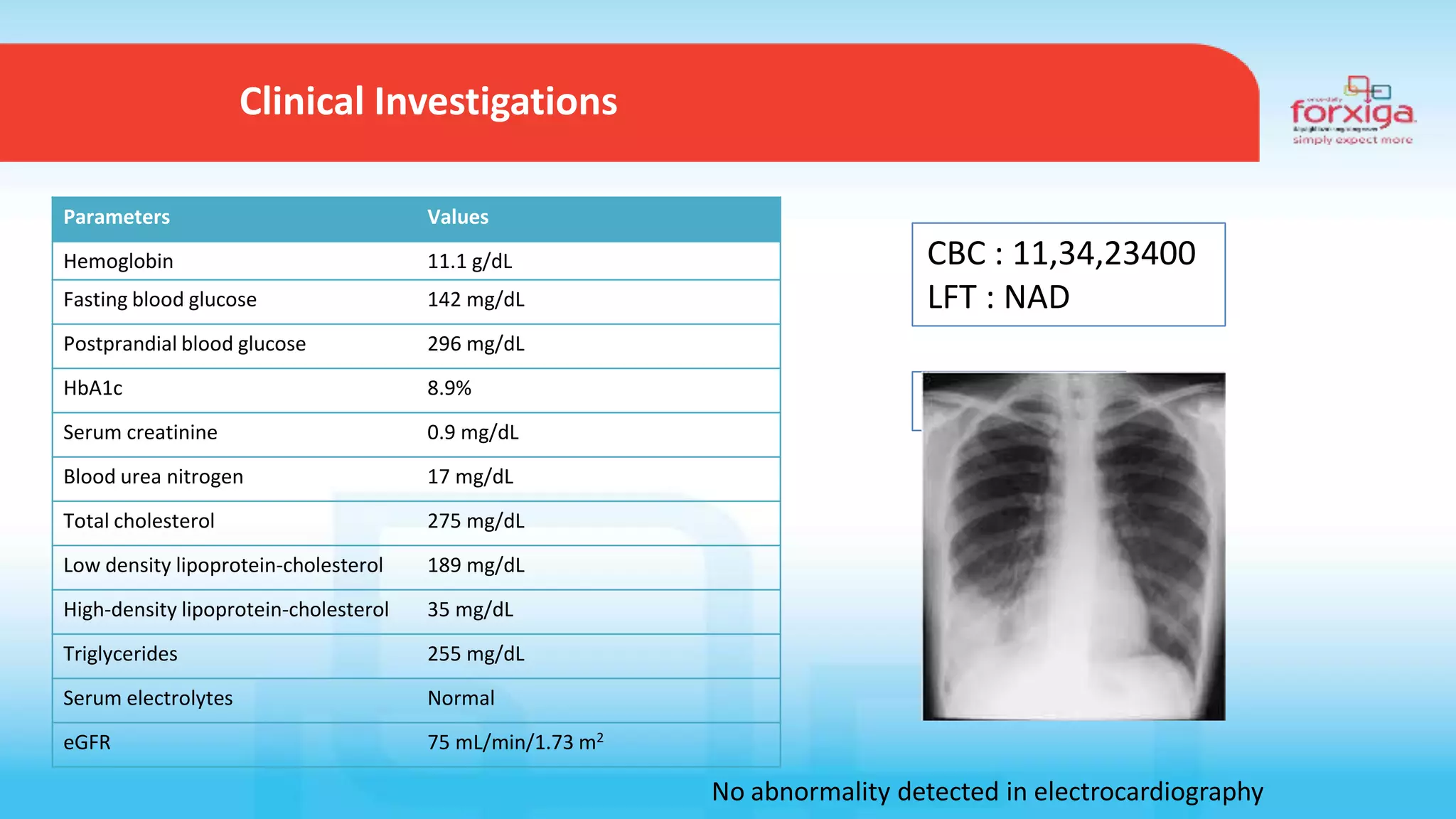 Clinical Investigations
No abnormality detected in electrocardiography
Parameters Values
Hemoglobin 11.1 g/dL
Fasting blood glucose 142 mg/dL
Postprandial blood glucose 296 mg/dL
HbA1c 8.9%
Serum creatinine 0.9 mg/dL
Blood urea nitrogen 17 mg/dL
Total cholesterol 275 mg/dL
Low density lipoprotein-cholesterol 189 mg/dL
High-density lipoprotein-cholesterol 35 mg/dL
Triglycerides 255 mg/dL
Serum electrolytes Normal
eGFR 75 mL/min/1.73 m2
CBC : 11,34,23400
LFT : NAD
X ray chest
 