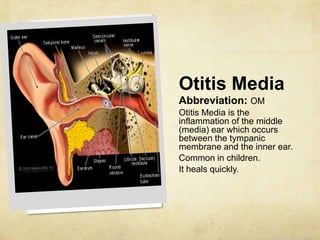 Otitis Media
Abbreviation: OM
Otitis Media is the
inflammation of the middle
(media) ear which occurs
between the tympanic
membrane and the inner ear.
Common in children.
It heals quickly.
 