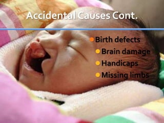 Accidental Causes Cont.Birth defectsBrain damageHandicapsMissing limbs