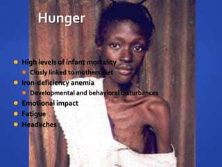 Absolute povertyHungerHigh levels of infant mortalityClosly linked to mothers dietIron-deficiency anemiaDevelopmental and behavioral disturbancesEmotional impactFatigueHeadaches