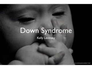 Down Syndrome
         Kelly Levinsky




                                                            laist.com/downsyndrome/photo113.htm


   http://www.treatgene.com/5-hypotheses-causing-syndrome
 