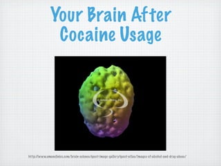 Your Brain After
               Cocaine Usage




http://www.amenclinics.com/brain-science/spect-image-gallery/spect-atlas/images-of-alcohol-and-drug-abuse/
 