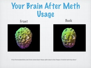 Your Brain After Meth
        Usage
             Front                                                                     Back




http://www.amenclinics.com/brain-science/spect-image-gallery/spect-atlas/images-of-alcohol-and-drug-abuse/
 