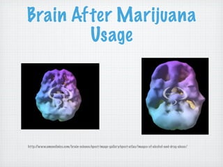 Brain After Marijuana
        Usage




http://www.amenclinics.com/brain-science/spect-image-gallery/spect-atlas/images-of-alcohol-and-drug-abuse/
 