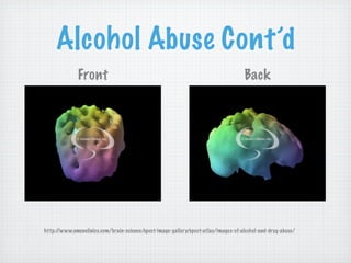 Alcohol Abuse Cont’d
              Front                                                                 Back




http://www.amenclinics.com/brain-science/spect-image-gallery/spect-atlas/images-of-alcohol-and-drug-abuse/
 