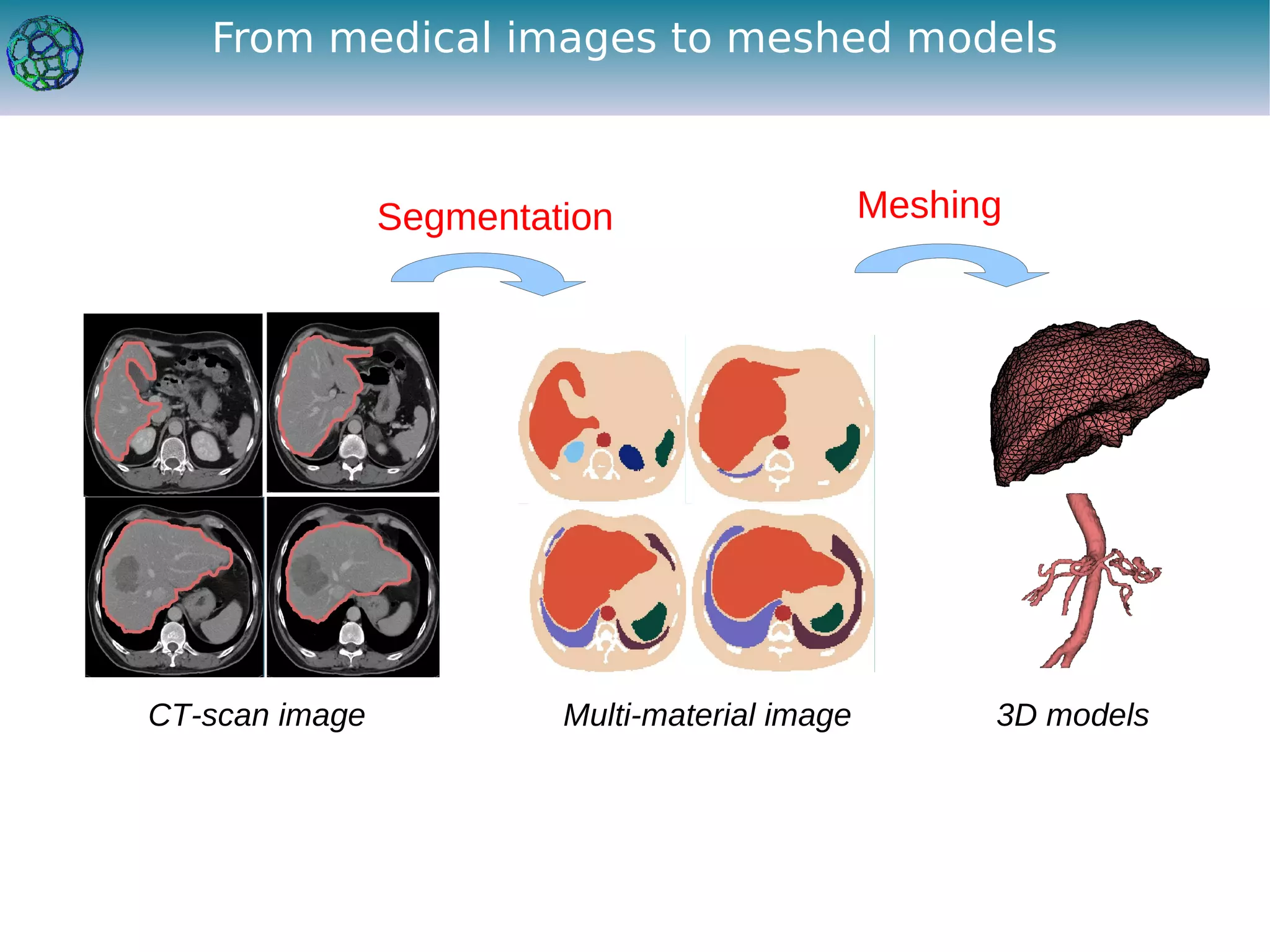 From medical images to meshed models



                Segmentation                    Meshing




CT-scan image            Multi-material image         3D models
 