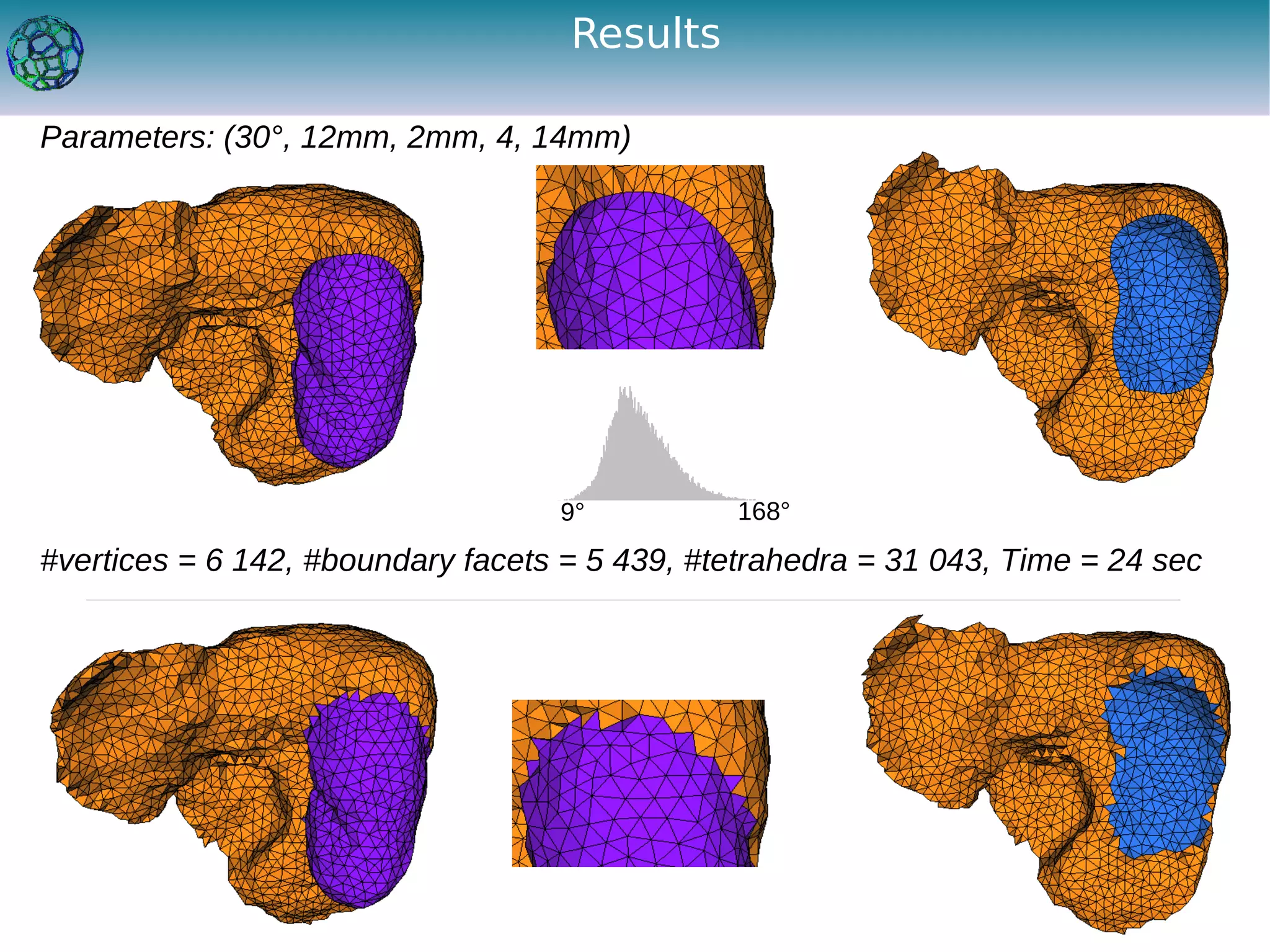 Results

Parameters: (30°, 12mm, 2mm, 4, 14mm)




                                   9°           168°
#vertices = 6 142, #boundary facets = 5 439, #tetrahedra = 31 043, Time = 24 sec
 