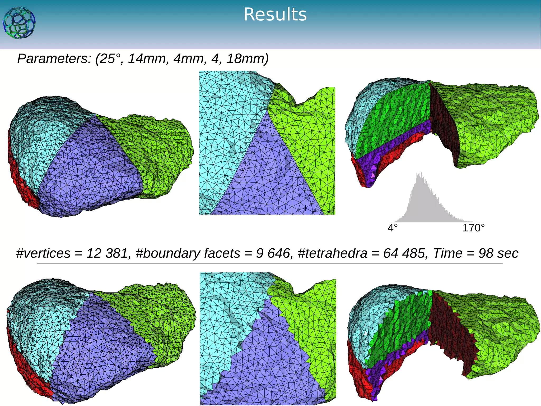 Results

Parameters: (25°, 14mm, 4mm, 4, 18mm)




                                                           4°          170°

#vertices = 12 381, #boundary facets = 9 646, #tetrahedra = 64 485, Time = 98 sec
 