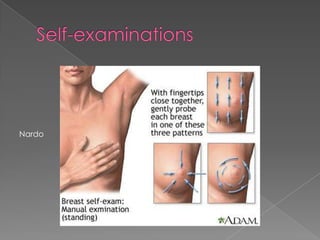 Self-examinationsNardo