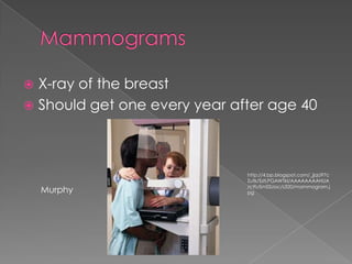 MammogramsX-ray of the breastShould get one every year after age 40http://4.bp.blogspot.com/_jjqU97cZutk/SstLPGAWTkI/AAAAAAAAHUA/c9LrSmSSUoc/s320/mammogram.jpgMurphy